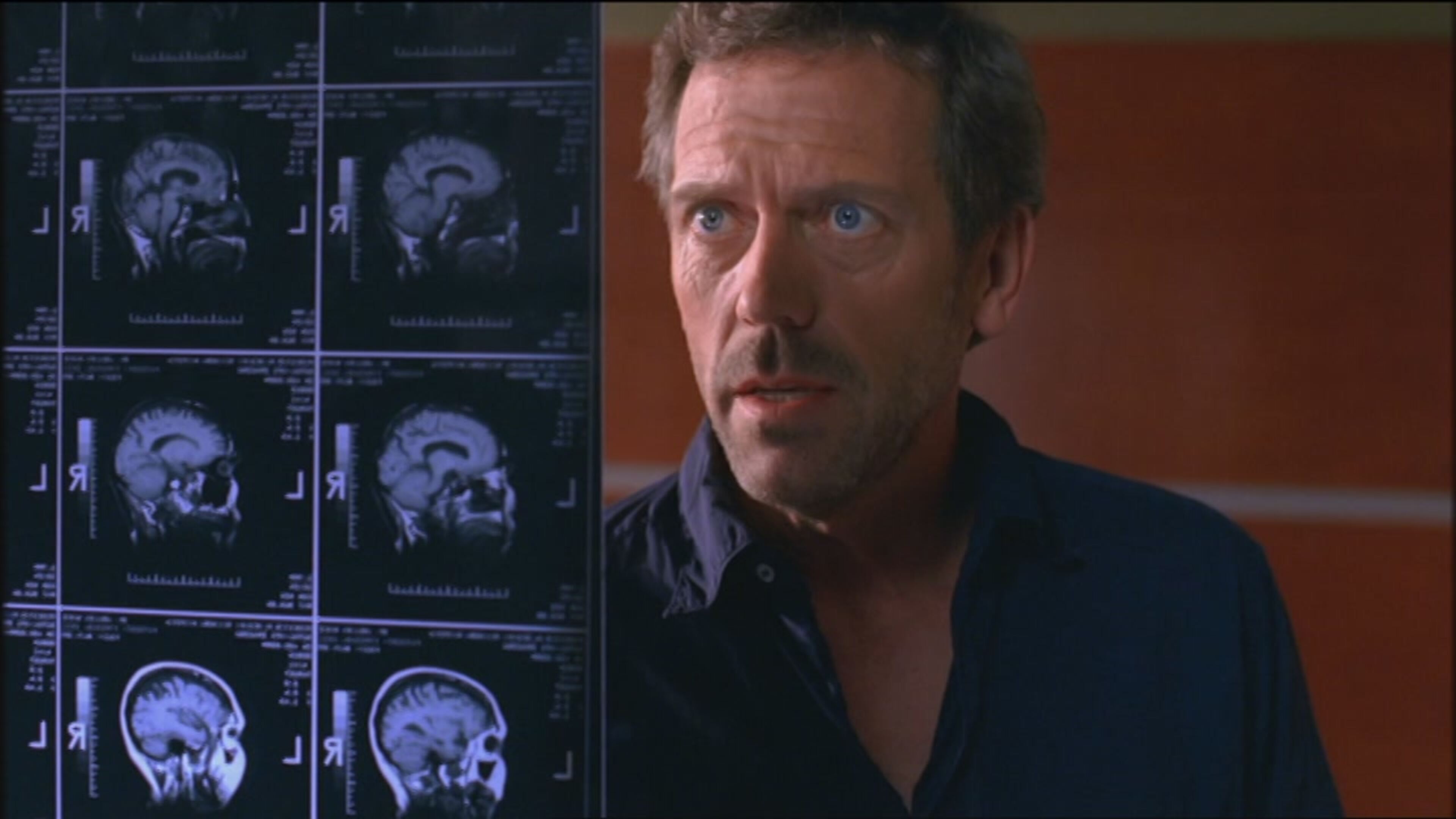 Dr. House - Medical Division 2 - S2 Ep14 Euforia - I parte